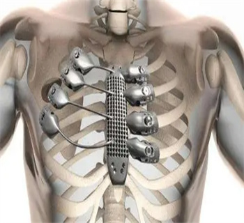 医疗植入物Medical Implants.jpg